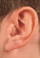 IN THE CANAL (ITC)Hearing Aid